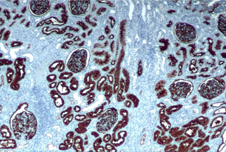 Exames Imunohistoquímicos